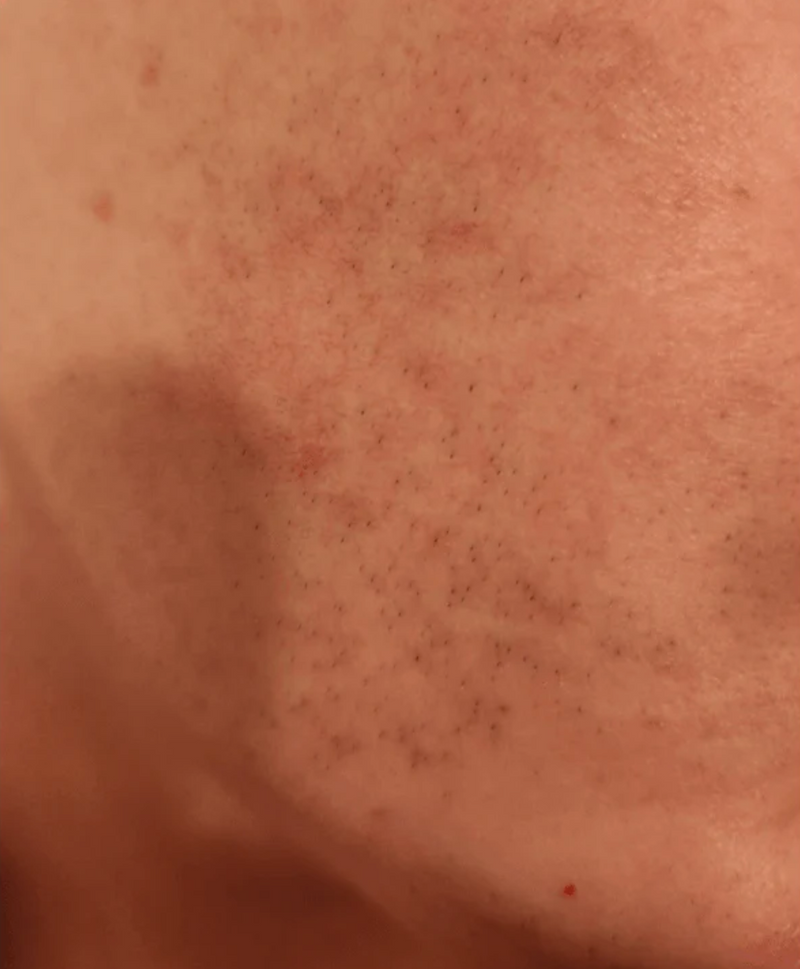 Before Image